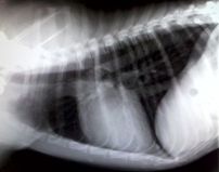 Corazon normal en radiografia
