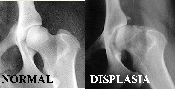 radiografies en displasia de maluc, dolor articular